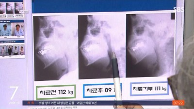 치매 위험 30% 증가 시키는 습관 ㄷㄷ