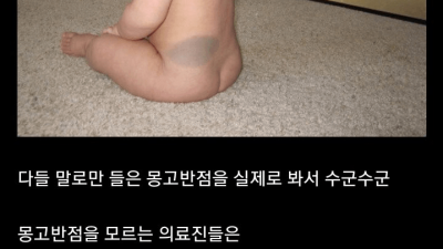 미국 의사들이 동양인 아기보면 경악하는 이유