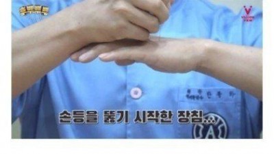 어릴 때 한번쯤 해본 바늘로 손 뚫기