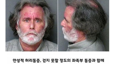 미국 병원비가 너무 비싸서 생긴 일