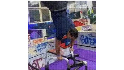 아프겠다..많이