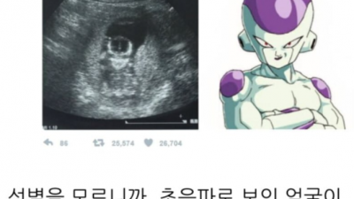 아기 태명이 프리저