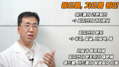  등드름 가드름이 나는 이유와 관리법