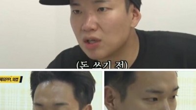  장성규 시술 전 후
